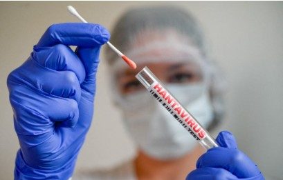 OMS señala que el hantavirus presenta mayor nivel de contagio en las primeras etapas de la enfermedad
